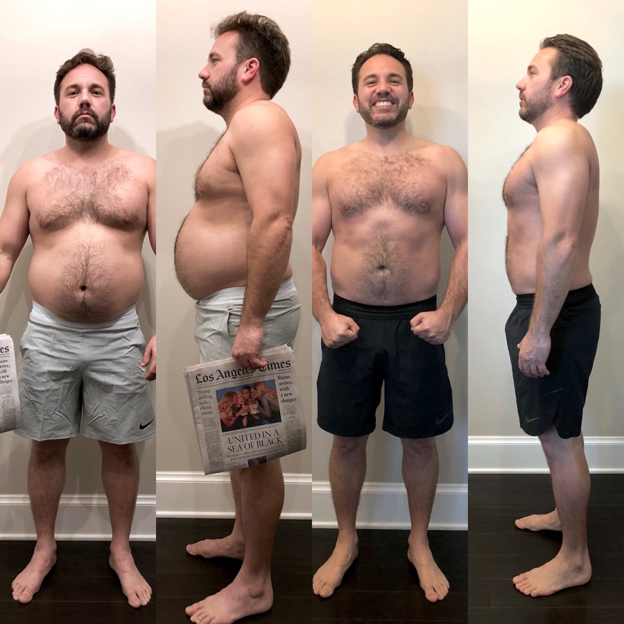 Male client four-panel front-and-side transformation